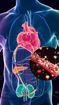 Cardiometabolic CKM Syndrome 3D Visualization: Integrated Heart, Kidney, and Pancreatic Health with 4D Flow MRI Data Overlays. A hyper-realistic 3D medical visualization 