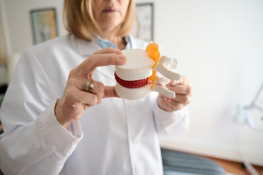 Doctor explaining spine health using vertebrae model