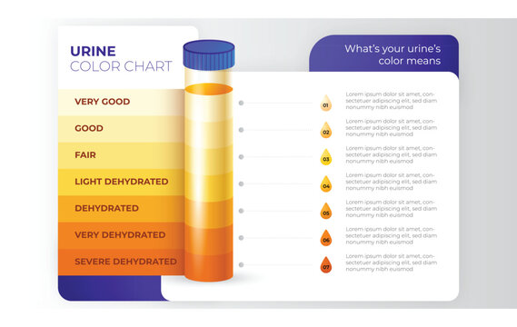 7-Step Urine Color Chart Infographic. Vector Medical Illustration for Hydration Levels, Dehydration Awareness, and Health Monitoring