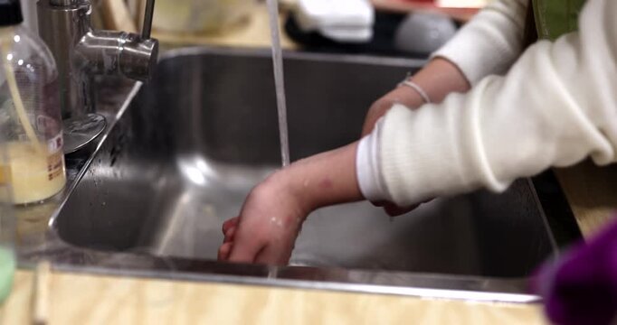 Careful hand washing in a stainless steel sink, focusing on personal hygiene and care for sensitive, irritated, or chapped skin, possibly affected by dermatitis, eczema, or an allergic reaction