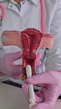 Medical suppositories and a woman uterus in the hands of a doctor. Vaginal suppositories and suppository treatment