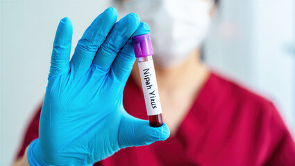 Obraz premium Close-up of female healthcare worker wearing gloves and mask holding blood sample labeled Nipah Virus, representing medical diagnostics, virus testing, biosafety, and infectious disease control