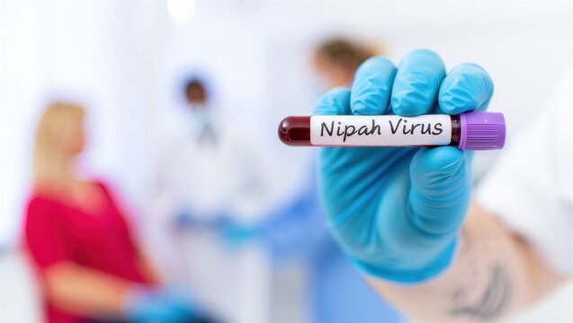 Medical gloved hand holding blood sample tube labeled nipah virus, laboratory diagnostics for zoonotic infection, infectious disease screening, outbreak investigation, clinical virology test