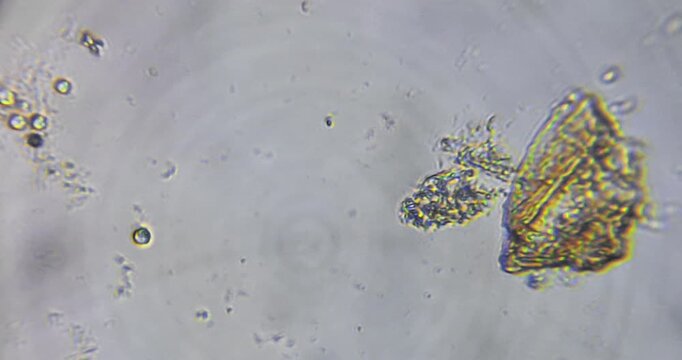 high-magnification microscopic footage revealing a natural micro ecosystem in a drop of water. Protozoa, amoeba-like organisms, rotifers, ciliates, and other microscopic life forms move in real time