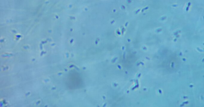 high-magnification microscopic footage showing living microorganisms in a natural aquatic environment. The video captures real-time movement of protozoa, ciliates, rotifers, amoeba