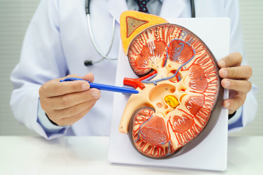 Chronic kidney disease, doctor with model for treatment urinary system, urology, Estimated glomerular filtration rate eGFR.