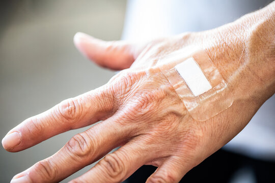 An elderly persons hand dressed with a hydrocolloid bandage in a brightly lit healthcare setting 