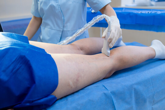 Doctor checking leg veins with diagnostic ultrasound imaging.