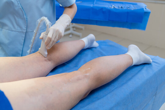 Doctor analyzing leg vein condition using ultrasound scan.