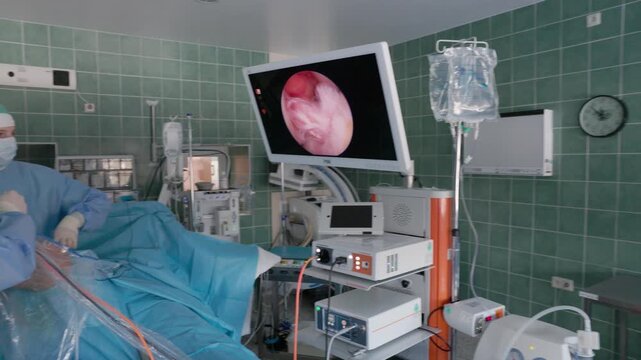 Surgeons in full sterile gear conduct a minimally invasive endoscopic surgery, with internal visuals displayed on a large monitor in a modern operating room