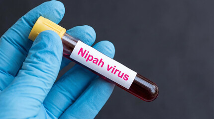 Obraz premium Nipah virus blood sample test held very carefully today now here