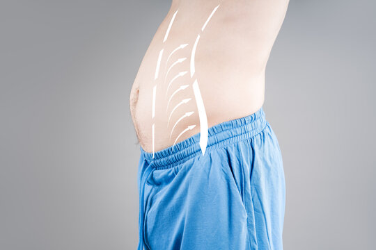 Weight loss and digestion concept, man belly with arrows showing fat reduction and metabolism improvement, bloating and tummy tuck