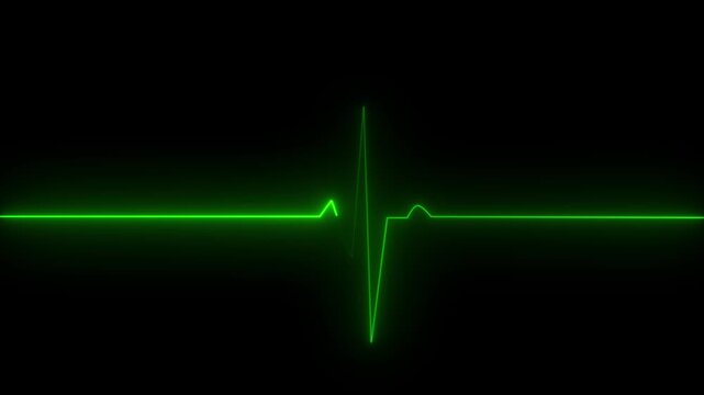 Cardiac arrest on the medical monitor, heart stops beating. Heart beating then hearts deadline on black background.