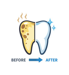 Obraz premium full color flat icon tooth with plaque spots on one side and clean side before after hygiene