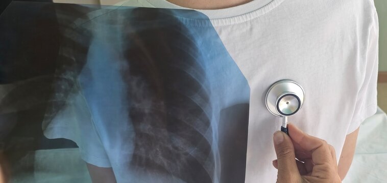 Pediatrician with stethoscope listening to a lungs in child with bronchitis and cough concept