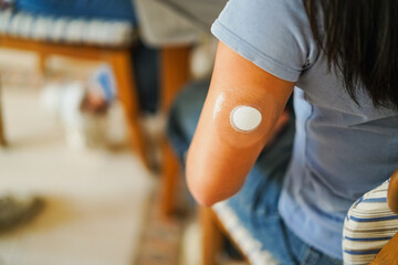 Young woman with diabetes patch - Lifestyle and people diseases concept - Focus on patch