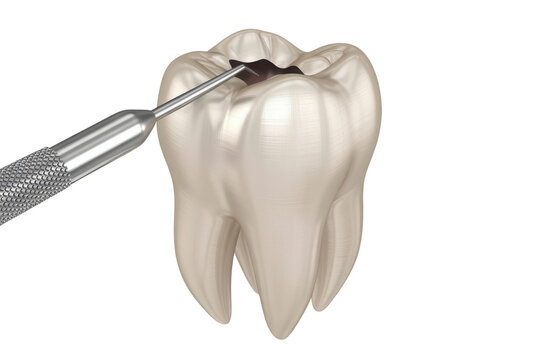 Dental tool placing filling isolated on transparent background