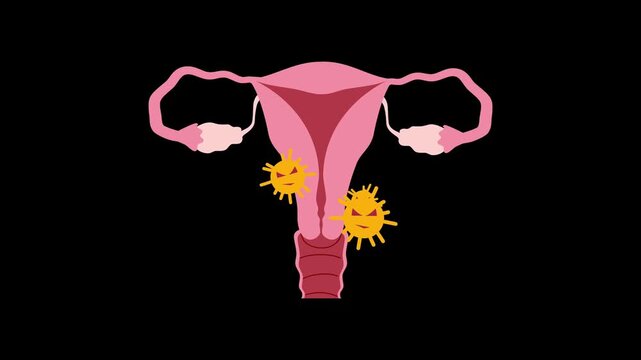 Viral or bacterial infection attacking the female reproductive system uterus