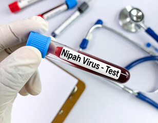 Nipah Virus Test Blood Sample