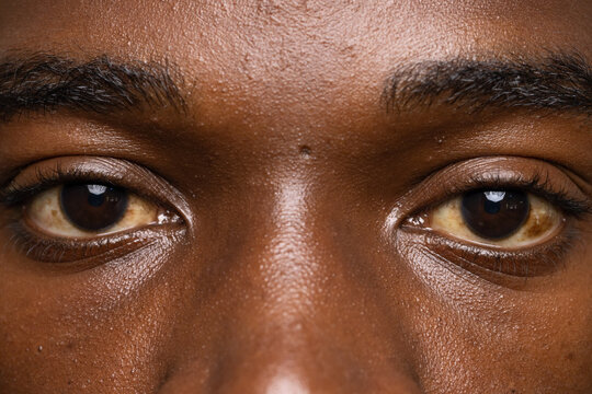 Brown eyes are filling frame and showing rectangular catchlights with visible skin texture