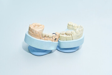 Dental molds depicting human teeth structure for orthodontic study and treatment. © elenavolf