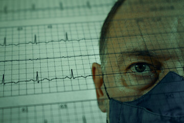 Worried adult male face over damaged electrocardiogram showing cardiac distress