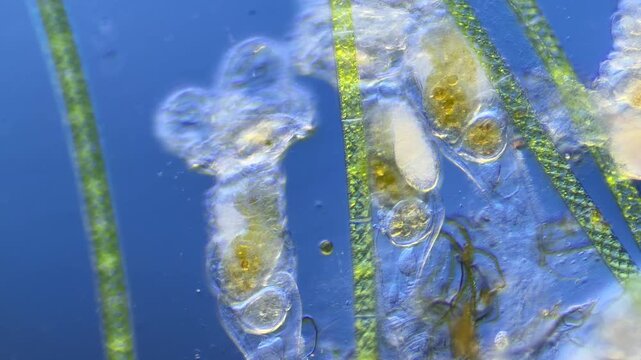 Sinantherina （rotifer） under the microscope