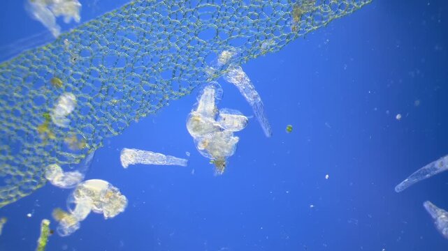 Sinantherina （rotifer） under the microscope