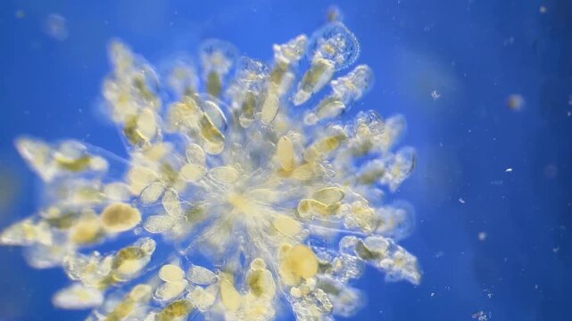 Sinantherina （rotifer） under the microscope