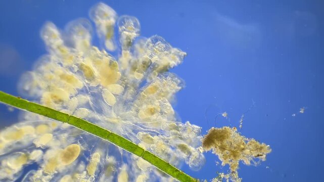 Sinantherina （rotifer） under the microscope