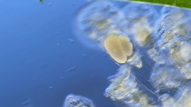 Sinantherina （rotifer） under the microscope