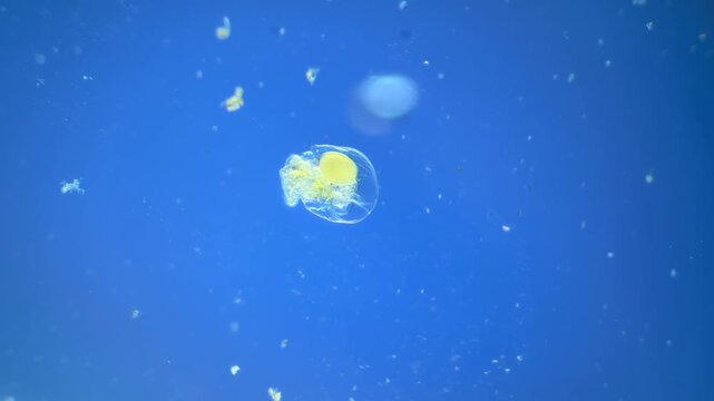 Sinantherina （rotifer） under the microscope