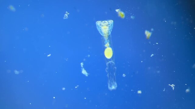 Sinantherina （rotifer） under the microscope