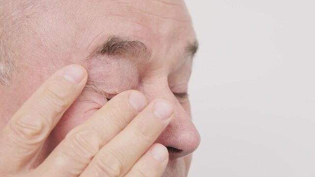 Close up mature senior man, fatigue syndrome eye Asthenopia, eye pain symptoms, including strain, allergies, blocked duct, severe eye conditions, corneal ulcers, glaucoma or acute angle-closure
