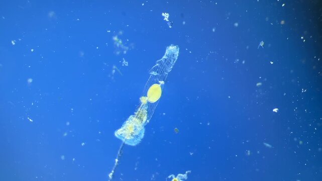 Sinantherina （rotifer） under the microscope