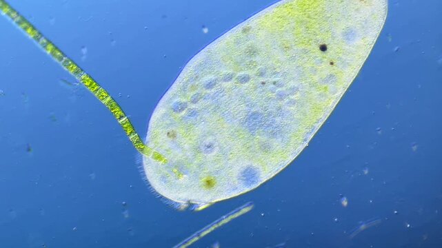 Ciliate Stentor under the microscope at 100x Magnification
