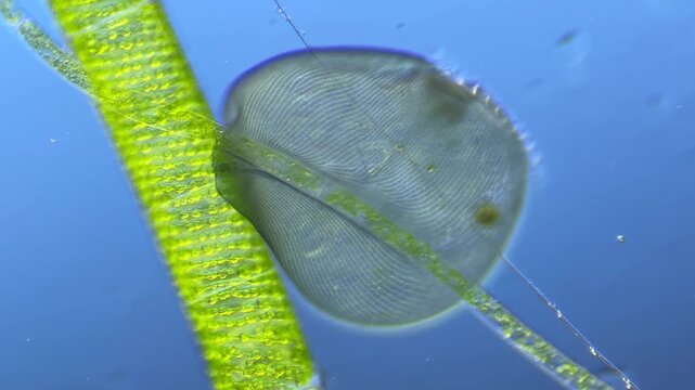 Ciliate Stentor under the microscope at 100x Magnification