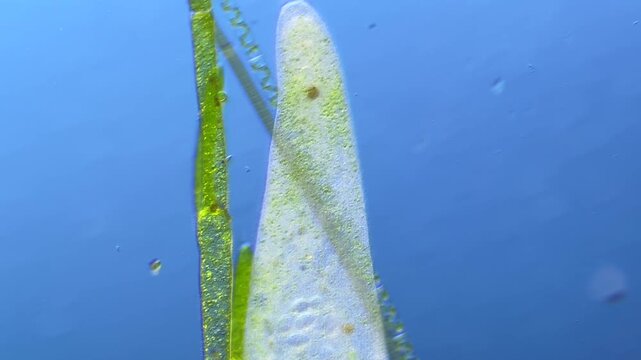 Ciliate Stentor under the microscope at 100x Magnification