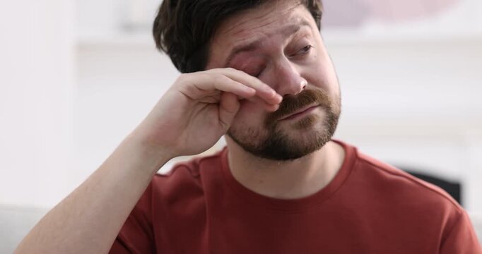Unhappy man feeling fatigue on sofa at home
