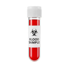 Sample in Test Tube with Biohazard Label on Black Background biohazard symbol red liquid