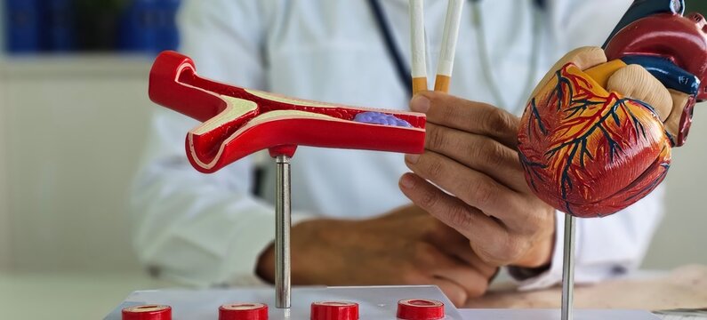 Cardiologist holds cigarettes and models of heart and artery