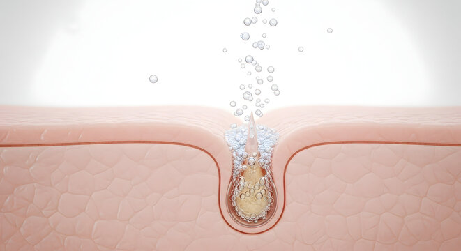 Pimple with pus in soft pink skin with gentle lighting for dermatology or skincare advertisement