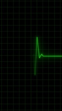 Animation of Endless loop EKG Heart Monitoring display. Full HD. 4K