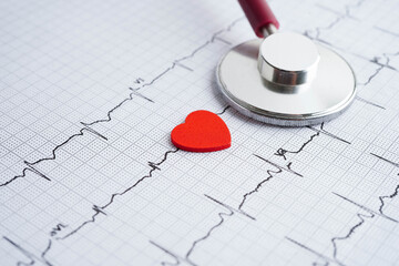 Stethoscope on electrocardiogram (ECG), heart wave, heart attack, cardiogram report.