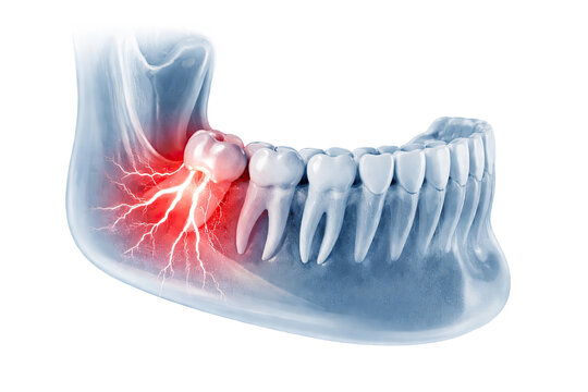 Human jaw anatomy showing tooth nerve pain inflammation and dental discomfort inside lower mandible on white background