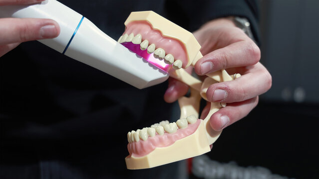 Dental scanner used on artificial teeth model. Close-up of a hand holding a dental model while using an intraoral scanner, demonstrating digital dentistry technology for teeth scanning.
