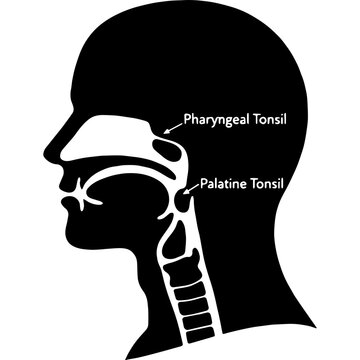 Healthy Tonsils Sagittal View Black Silhouette Anatomy