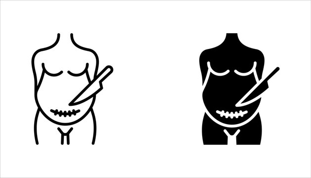 cesarean section icon set with scar, vector illustration on white background