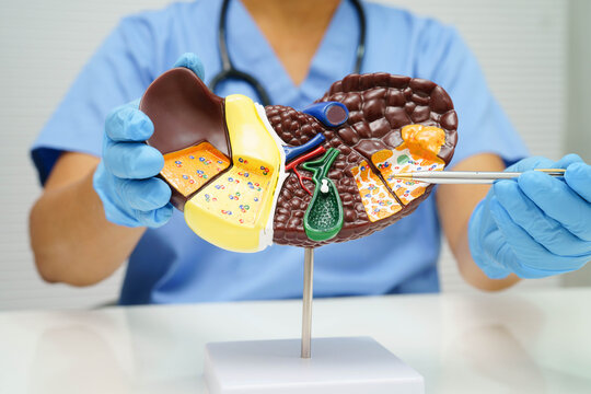 Cirrhosis, Liver cancer, fatty liver, Asian doctor with liver human anatomy model in World Hepatitis Day at hospital.