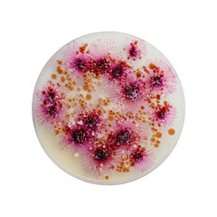 Petri dish filled with colorful, spiky colonies growing on a pale medium